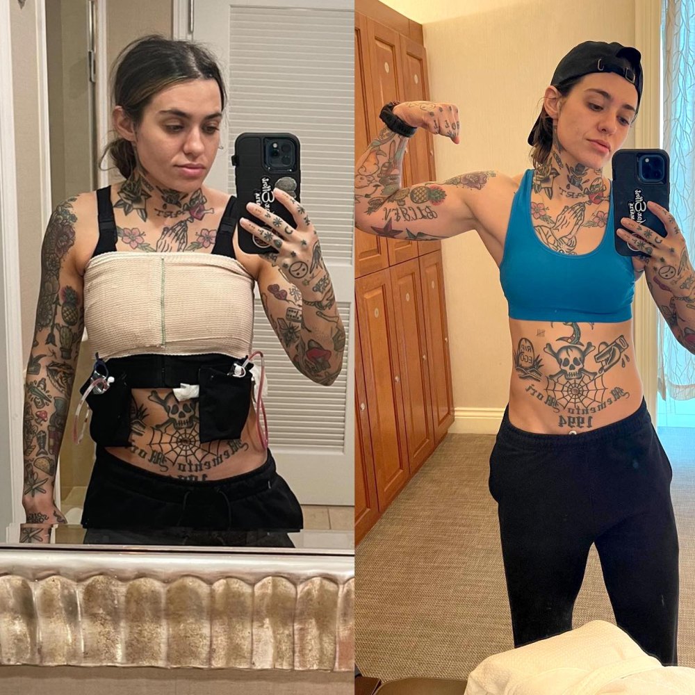 Morgan Wade Is ‘Still Adjusting’ to Her Body Following Double Mastectomy