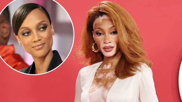 What Has Winnie Harlow Said About ANTM Tyra Banks