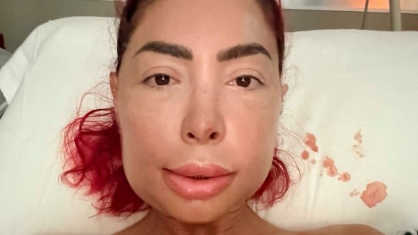 Feature Farrah Abraham Is Unrecognizable Following Jaw Surgery