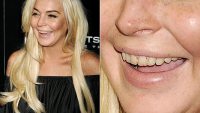 1318524824 Lindsay Lohan Teeth Article ?w=200&h=113&crop=1