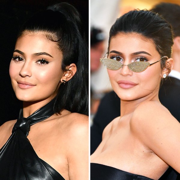 How Kylie Jenner Could Be Dissolving Her Filler Doctor