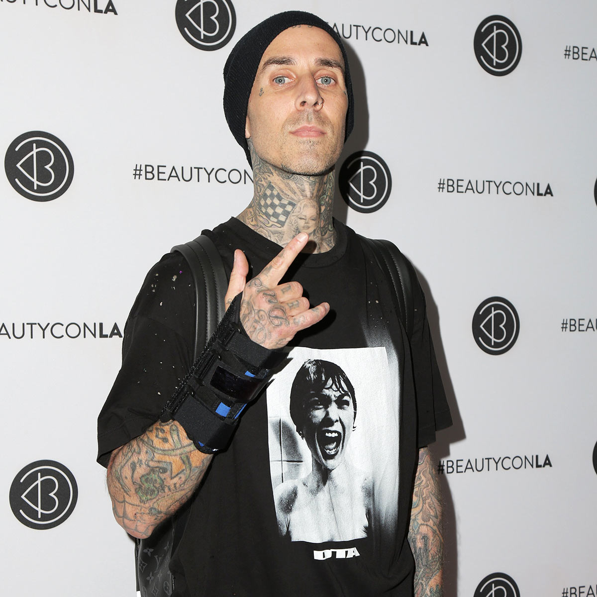 Travis Barker Shares Health Update Following Car Accident Blood