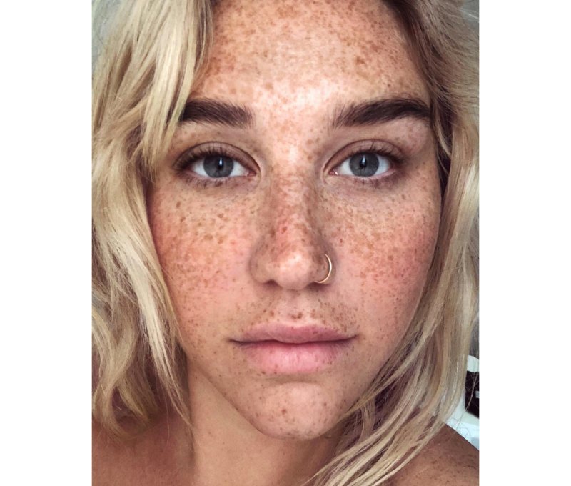 kesha-freckles-no-makeup