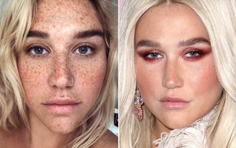 kesha-no-makeup-vs-makeup