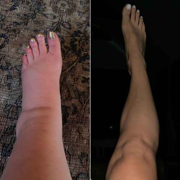 Jessica Simpson’s Postpartum Ankle Pic After Swollen Pregnancy Feet