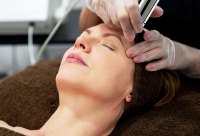 El Lifting Facial No Invasivo de Forma