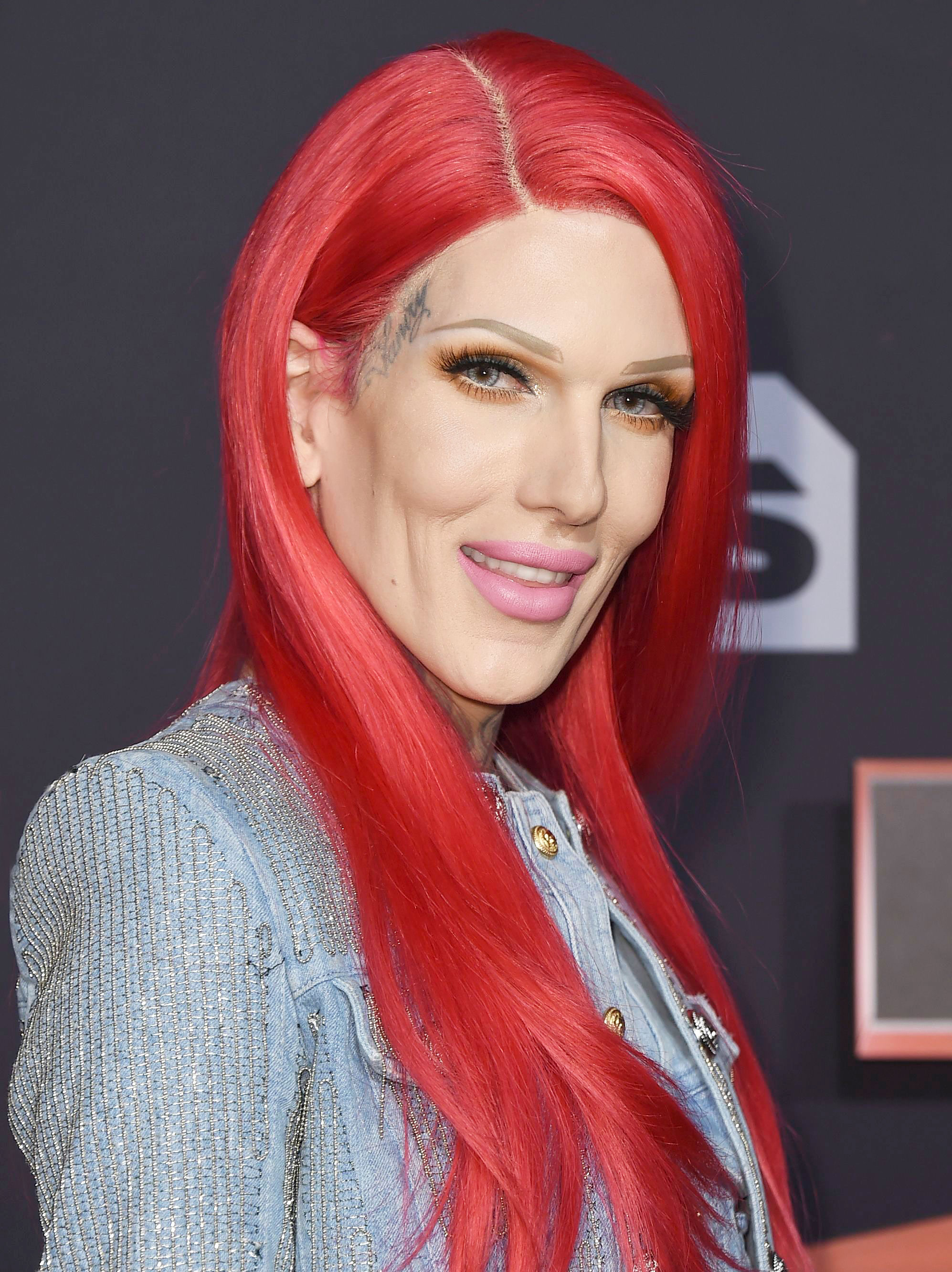 Jeffree Star Gets Botox Injections for 