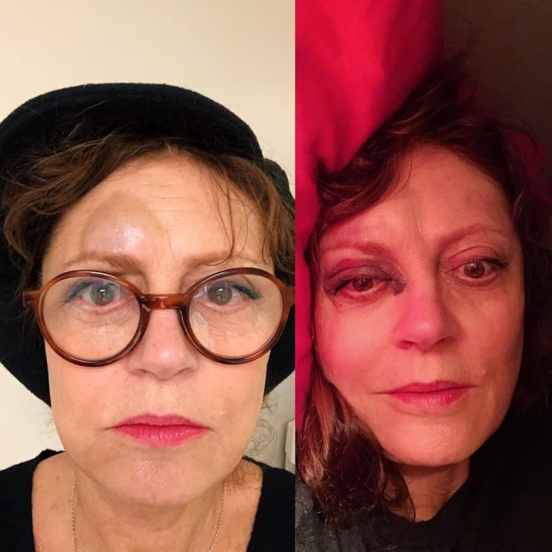 Susan Sarandon Suffers Concussion After Fall