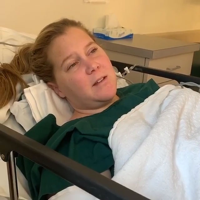 Amy Schumer Posts Videos From Egg Retrieval Day During Ivf Journey