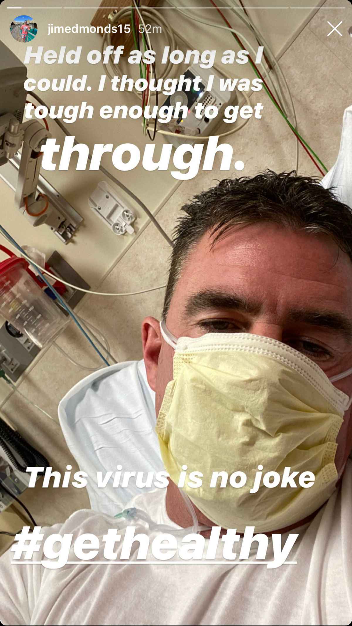 Former Angels star Jim Edmonds goes to hospital for coronavirus testing –  Orange County Register