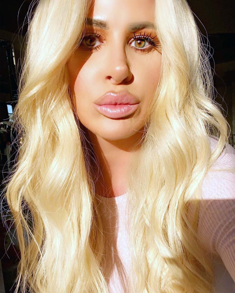 The Evolution Of Kim Zolciak Biermanns Lip Fillers Pics