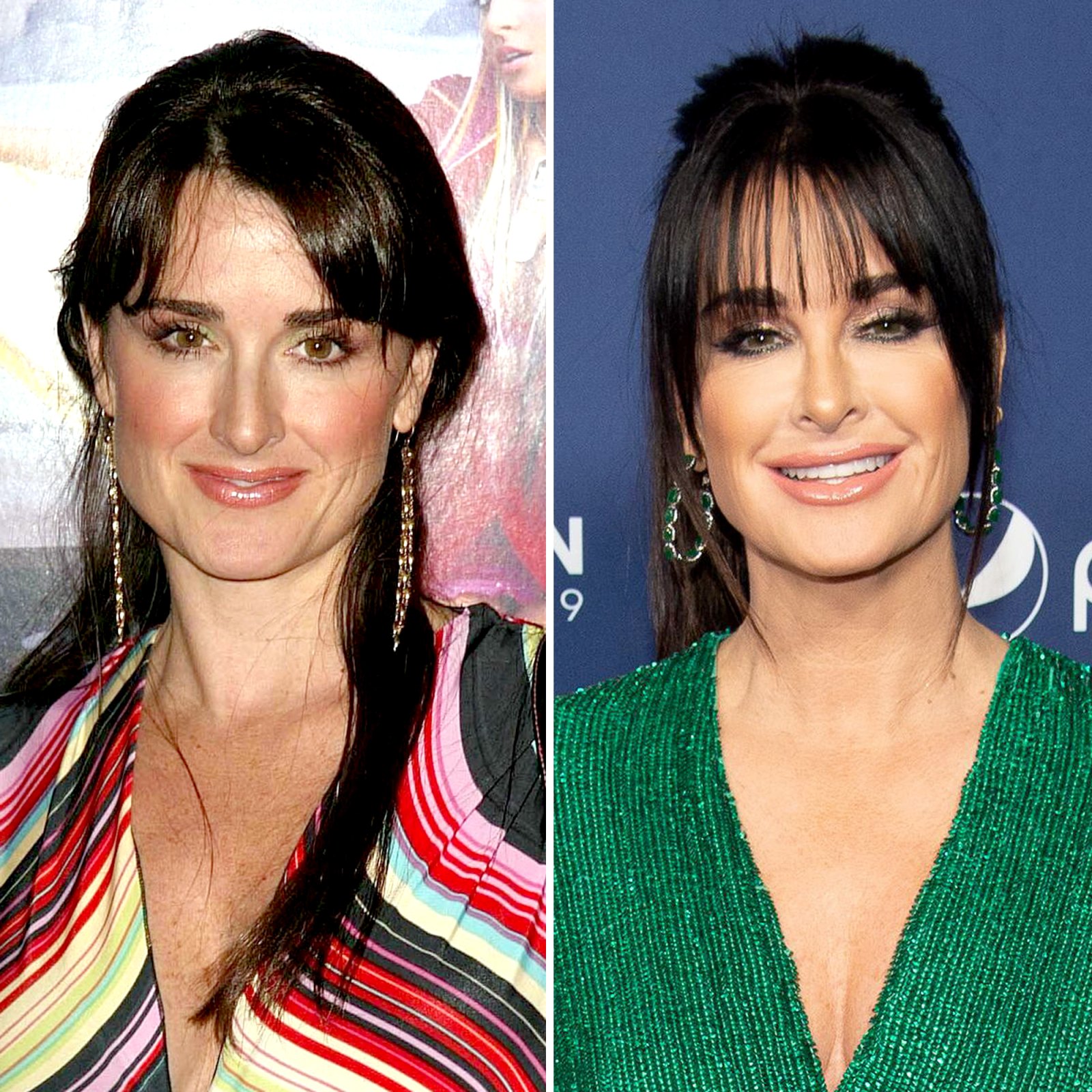 Kyle Richards Before And After Plastic Surgery ?w=1600&quality=86&strip=all