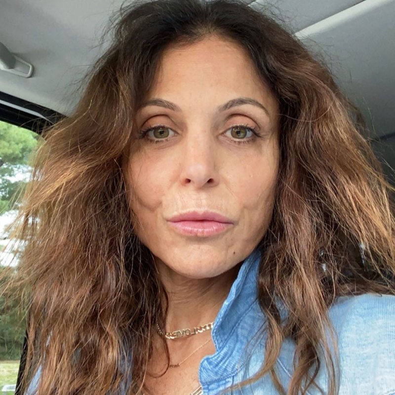 Bethenny Frankel Claps Back Against Plastic Surgery Accusations 