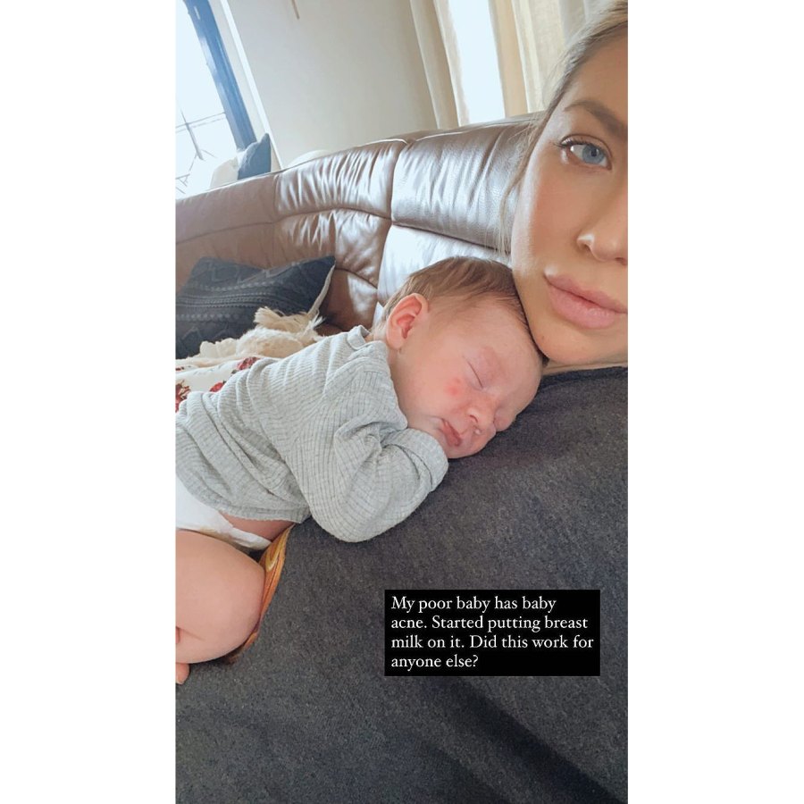 Stassi Schroeder Asks for Advice for Poor Daughter Hartford’s Baby Acne