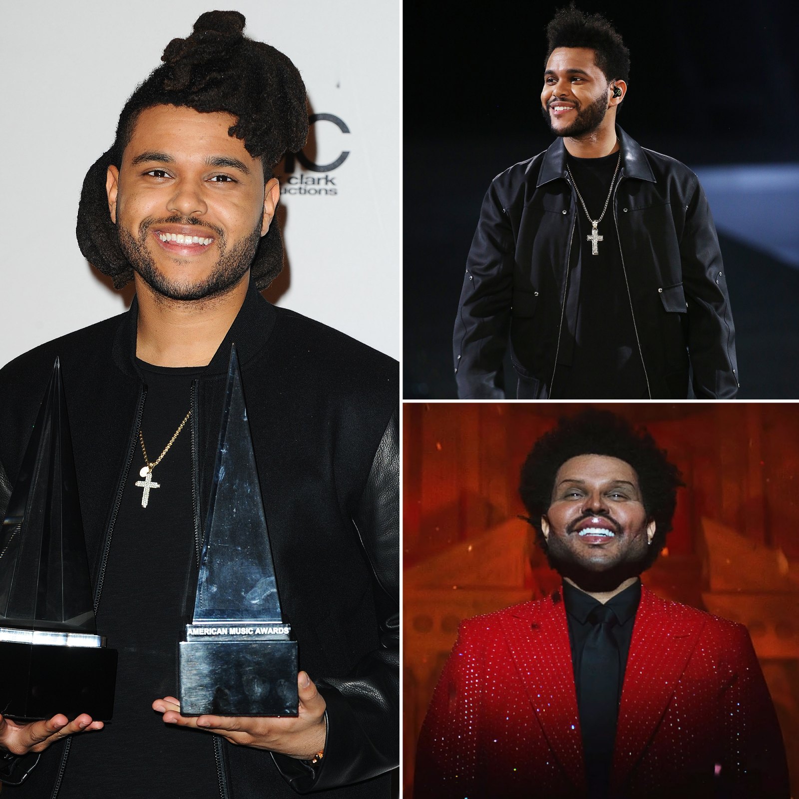 The Weeknd Through the Years: Drastic Haircuts, Shocking Prosthetics