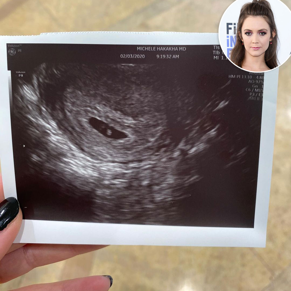 Pregnant Vanessa Morgan Shares Sonogram of Her Baby Boy on the Way
