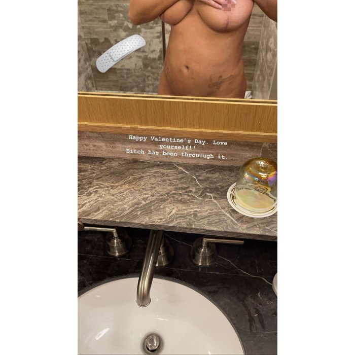 Black Nudists Beauty Pagent - Chrissy Teigen Posts Nude Selfie 1 Week After Endometriosis Surgery