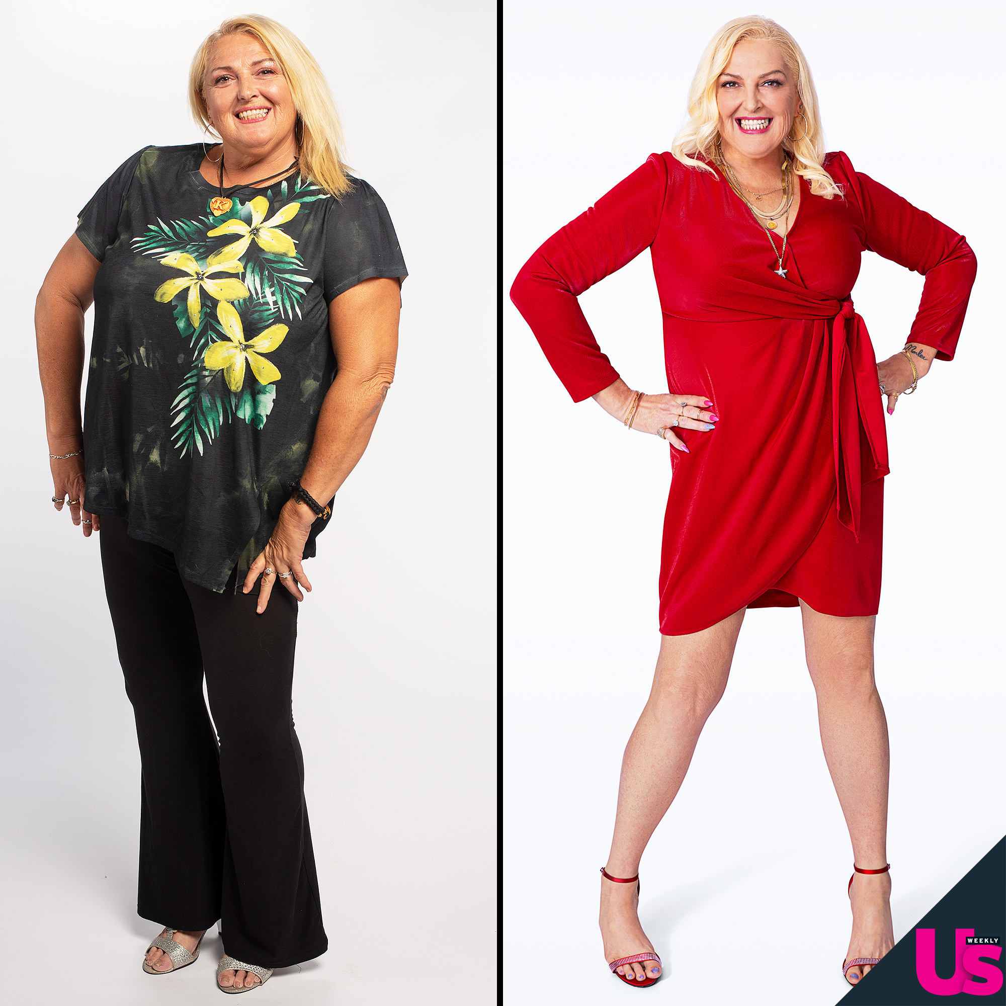 90 Day Fiance S Angela Drops 90 Lbs After Lipo Before After Pics