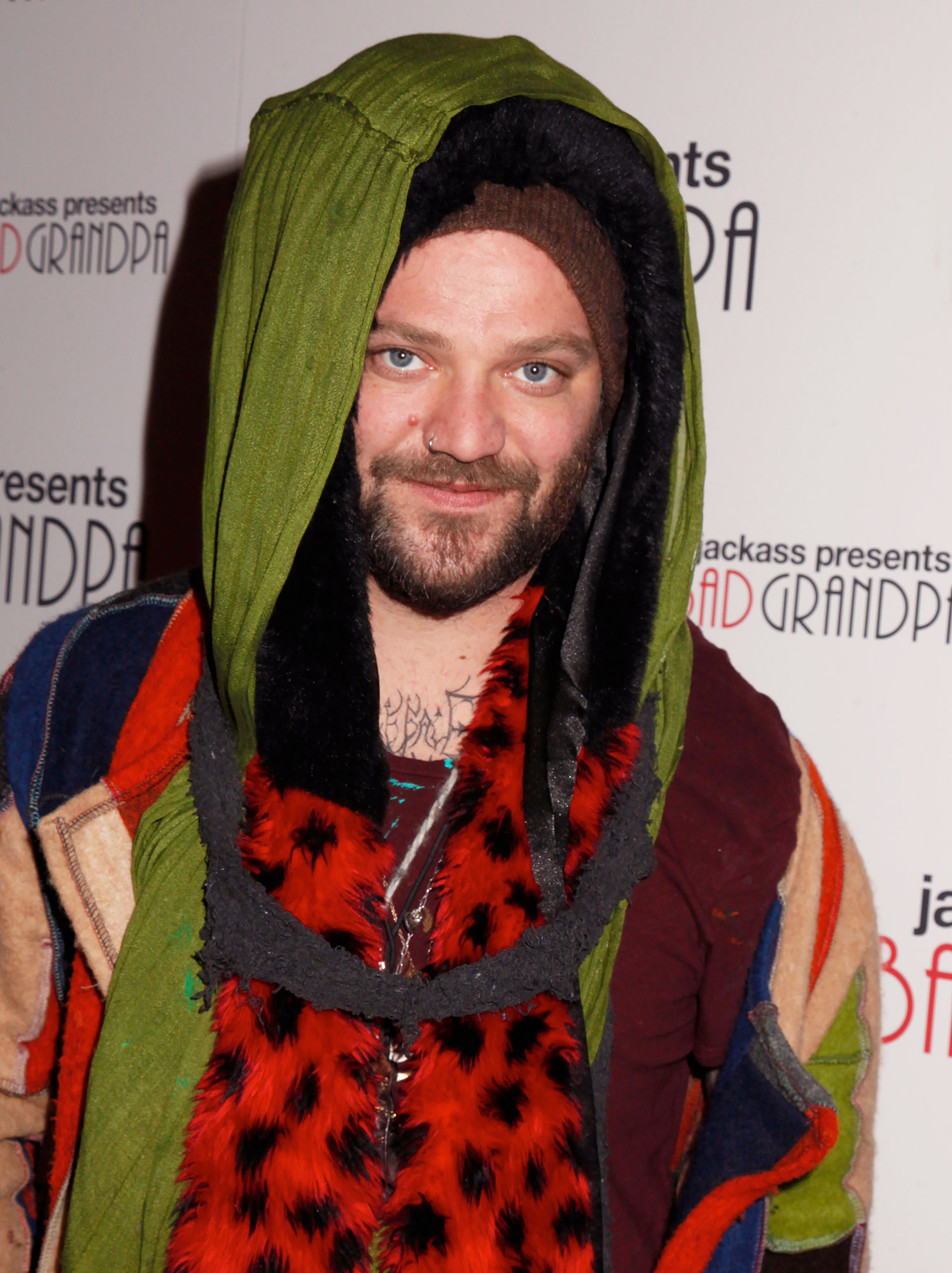 Bam Margera hospitalised with a staph infection after weeks of concerning  behaviour  9Celebrity