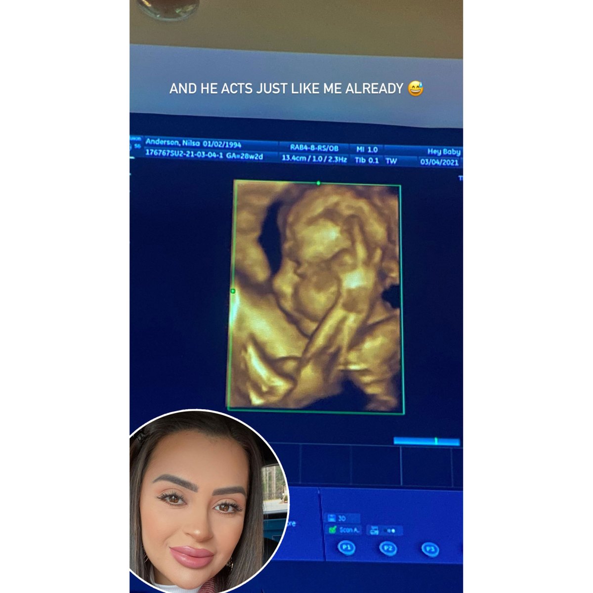 Riverdale star Vanessa Morgan shares ultrasound photo amid divorce