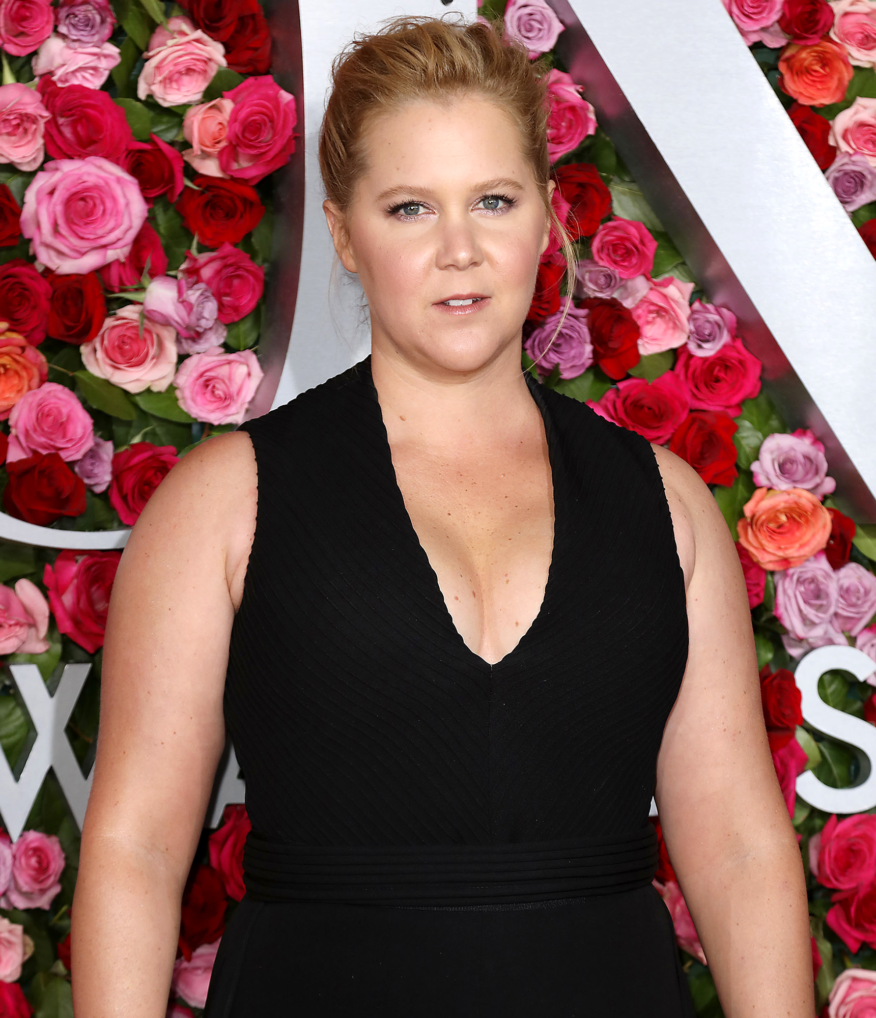 Amy Schumer feels 'like a new person' after operations to treat  endometriosis