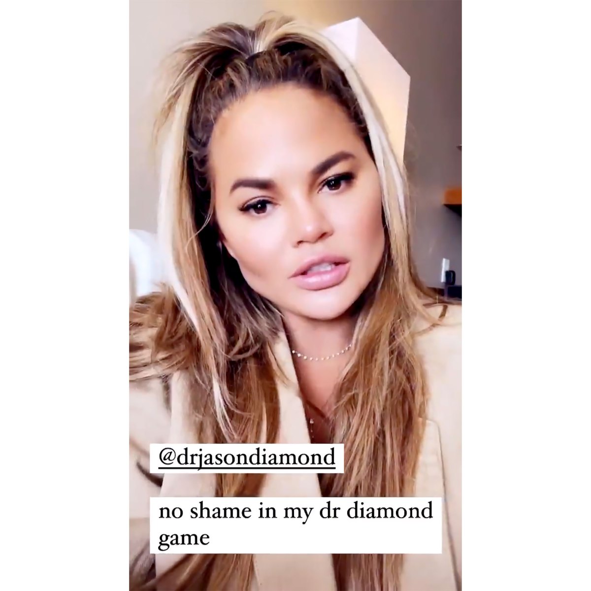 Chrissy Teigen Reveals Results Of ‘fat Removal Face Surgery Photo Us Weekly 