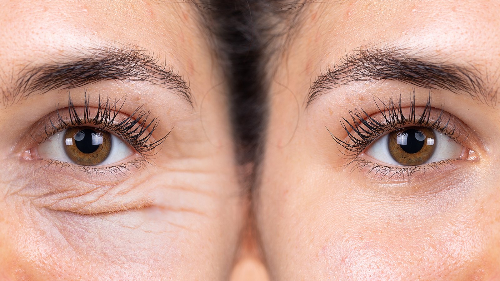 13 Best Under Eye Wrinkle Treatments, According to Experts 2024