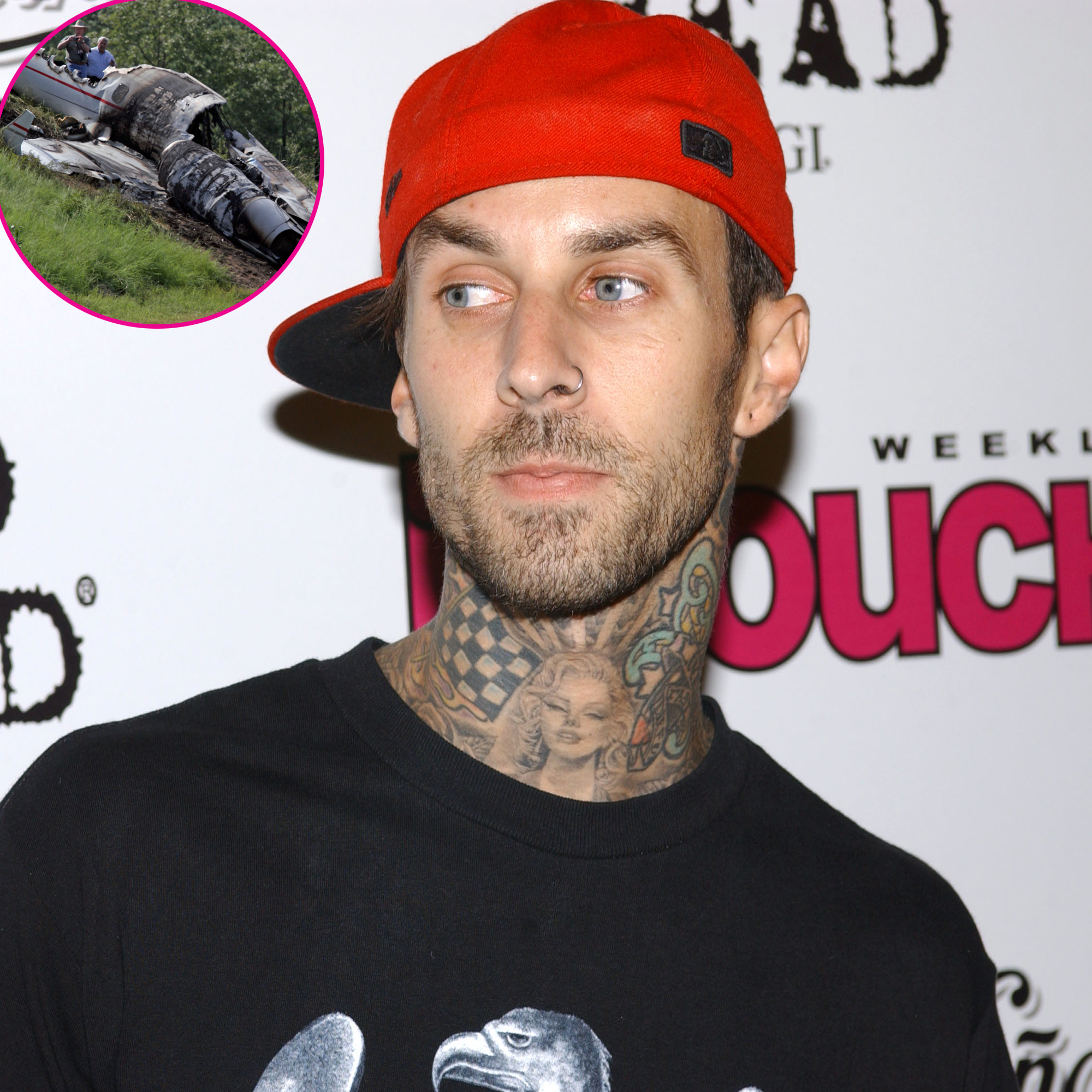 Travis Barker s Health Scares Injuries Through the Years Us Weekly