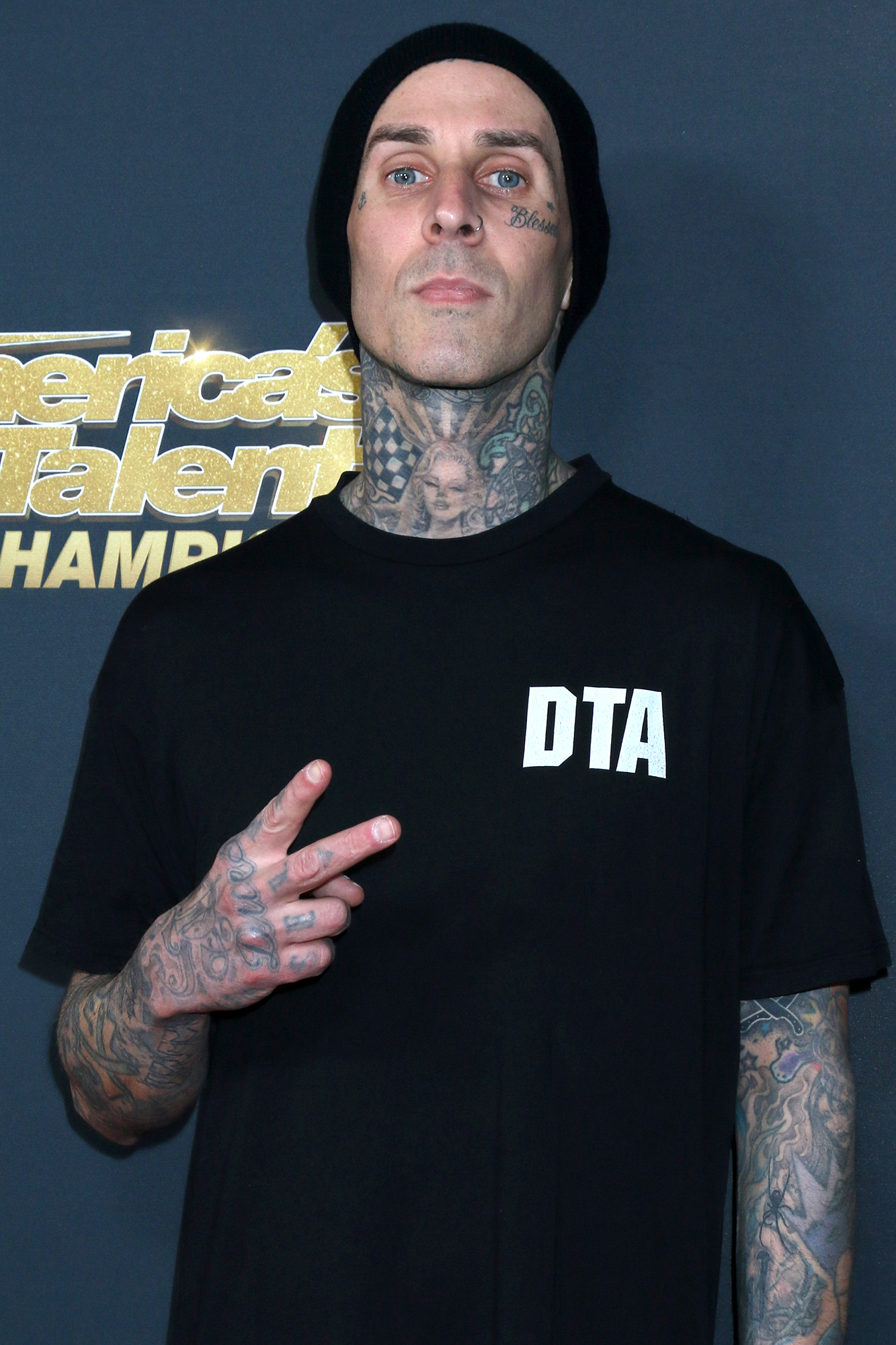 Travis Barker s Health Scares Injuries Through the Years Us Weekly