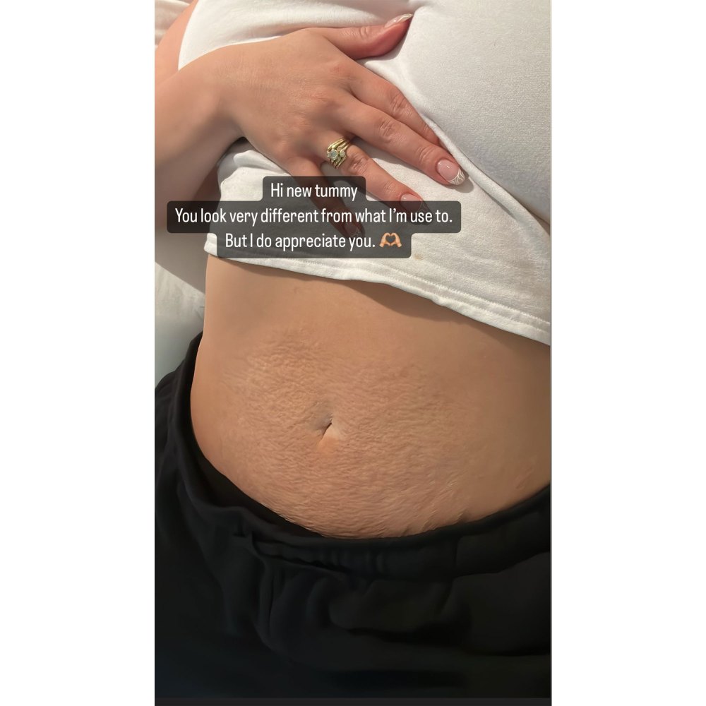 Ashley Graham Appreciates Postpartum Tummy After Childbirth: Pic
