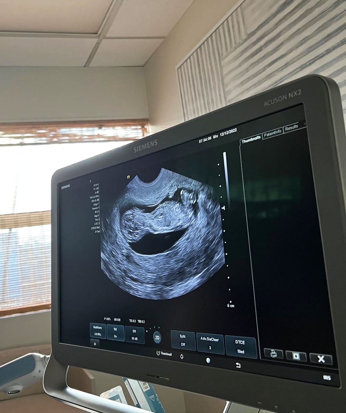 Naomi Osaka Is Pregnant, Expecting 1st Child With Boyfriend Cordae