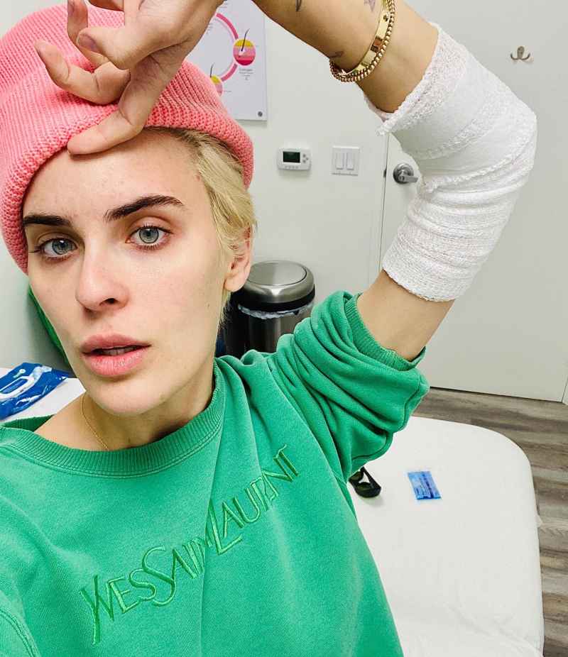 Celebrities Who-ve Had Their Tattoos Removed