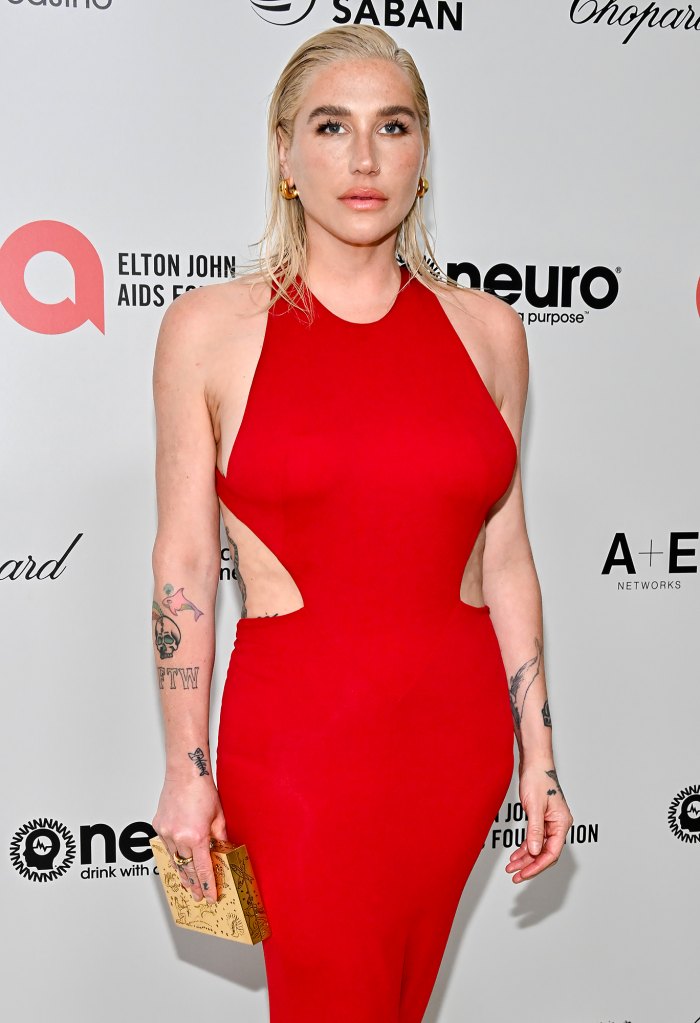 Kesha detalla la 'hermosa' recuperación del trastorno alimentario: 'No sé cuál es mi talla de pantalón'
