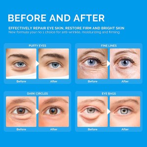 enaskin-eye-masks-before-after