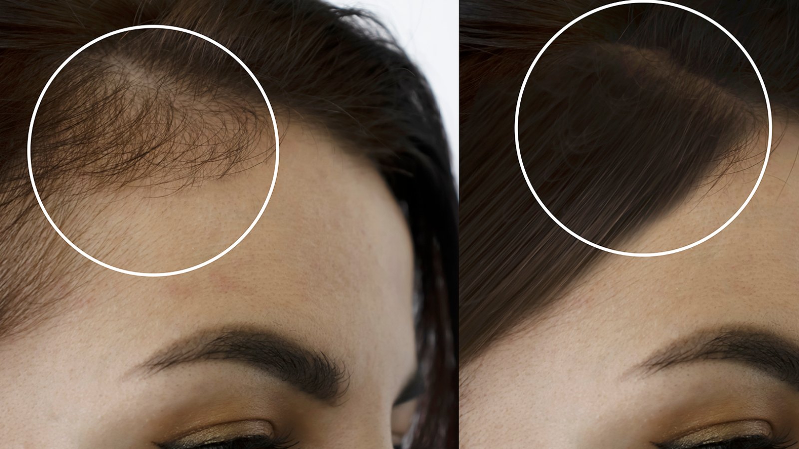 woman head baldness before and after treatment