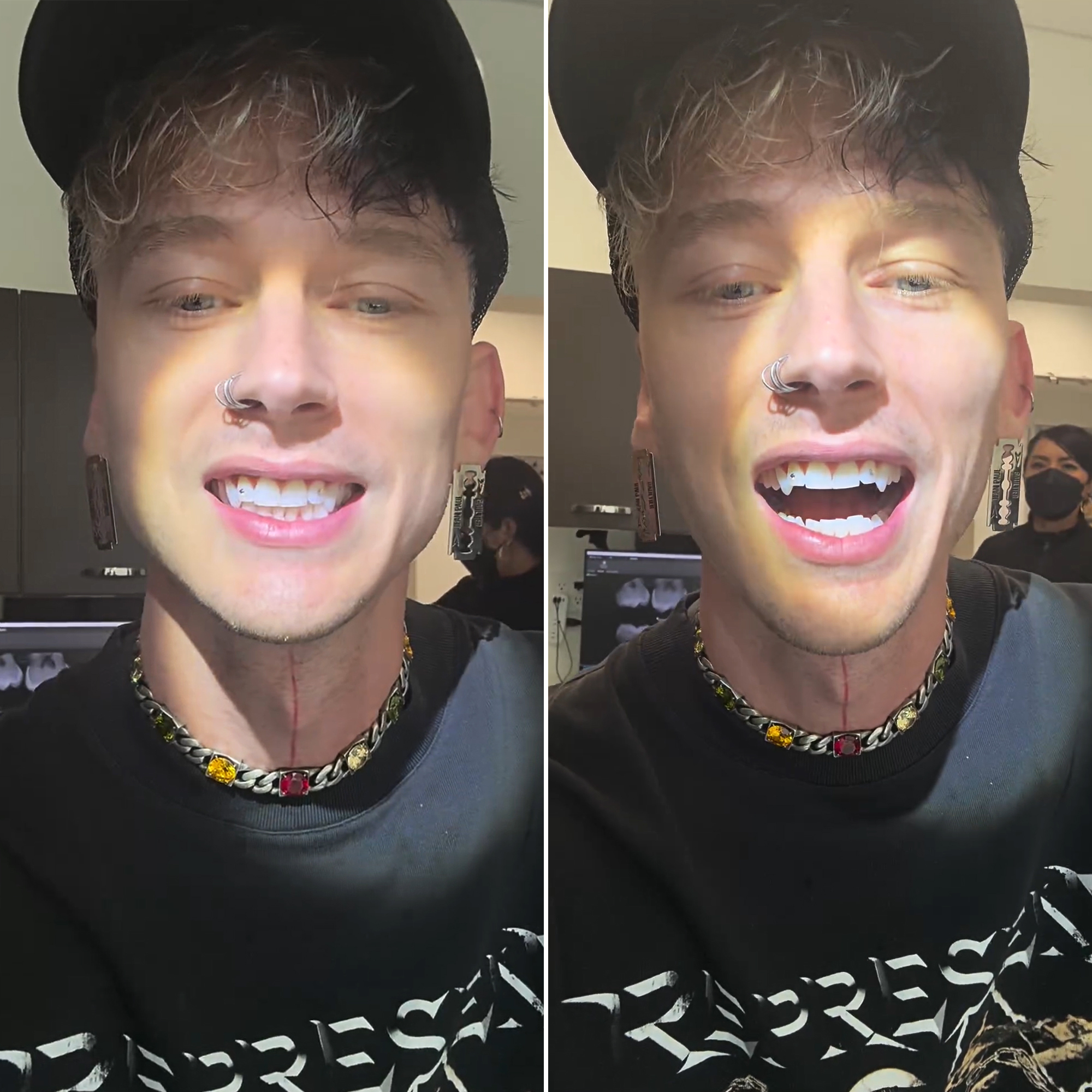 Machine Gun Kelly โชว์เขี้ยวและรอยสักที่คอแบบใหม่: 'Need Em Sharpened'