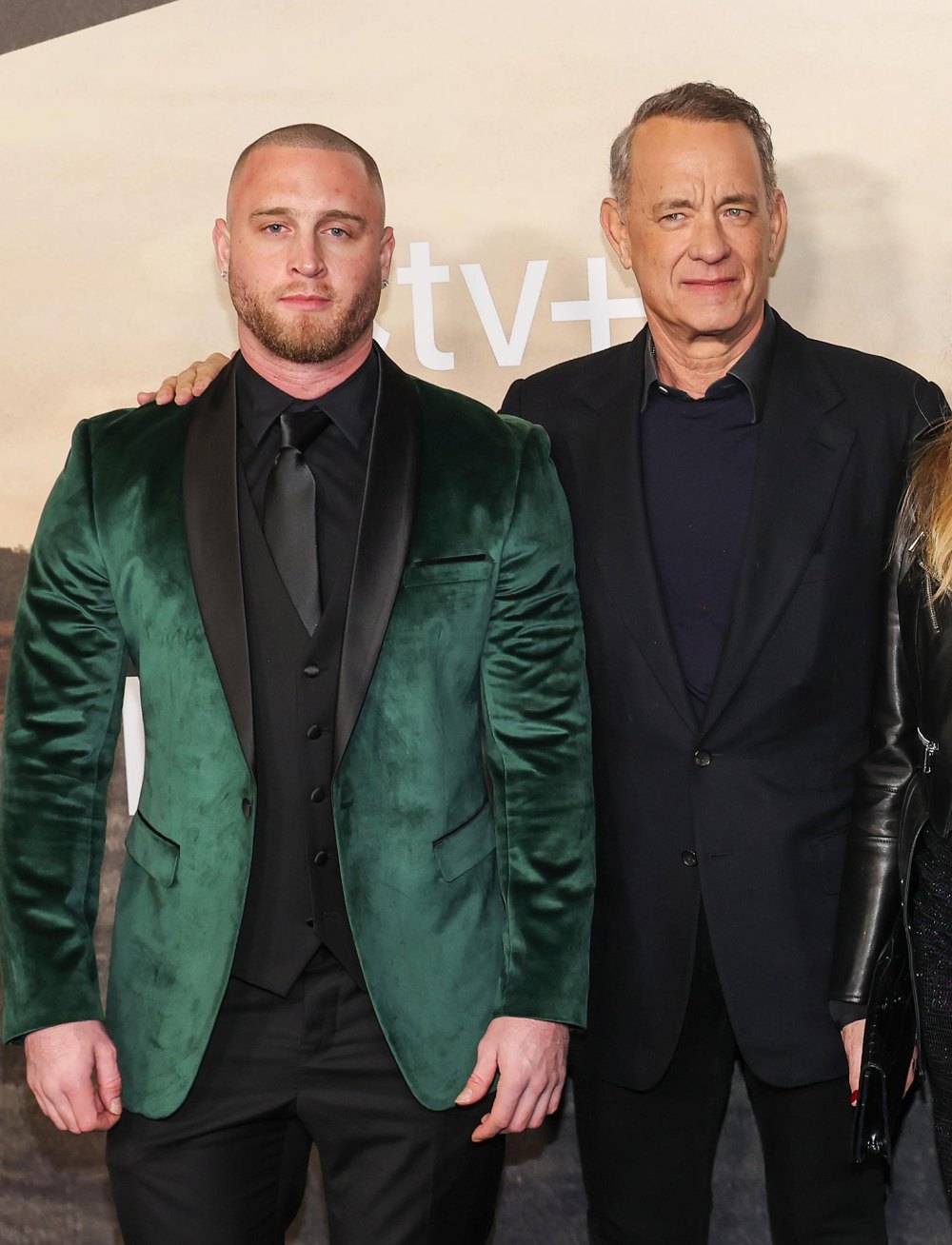 Tom Hanks Son Chet Hanks Has No Shame After Getting His Forehead Blasted With Botox 493