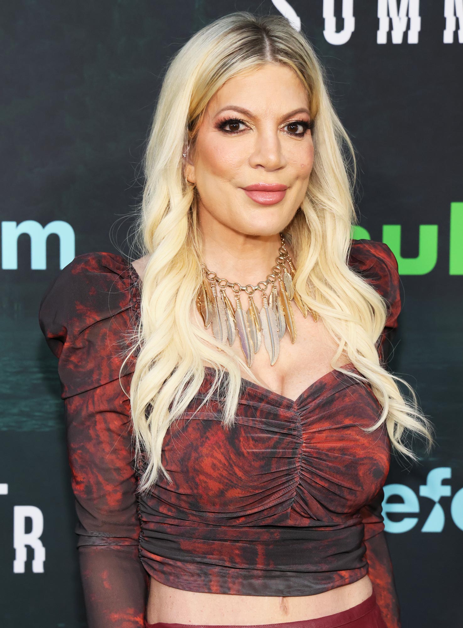 Tori Spelling ganha folheados e explica por que seu sorriso ‘destruiu’ sua confiança