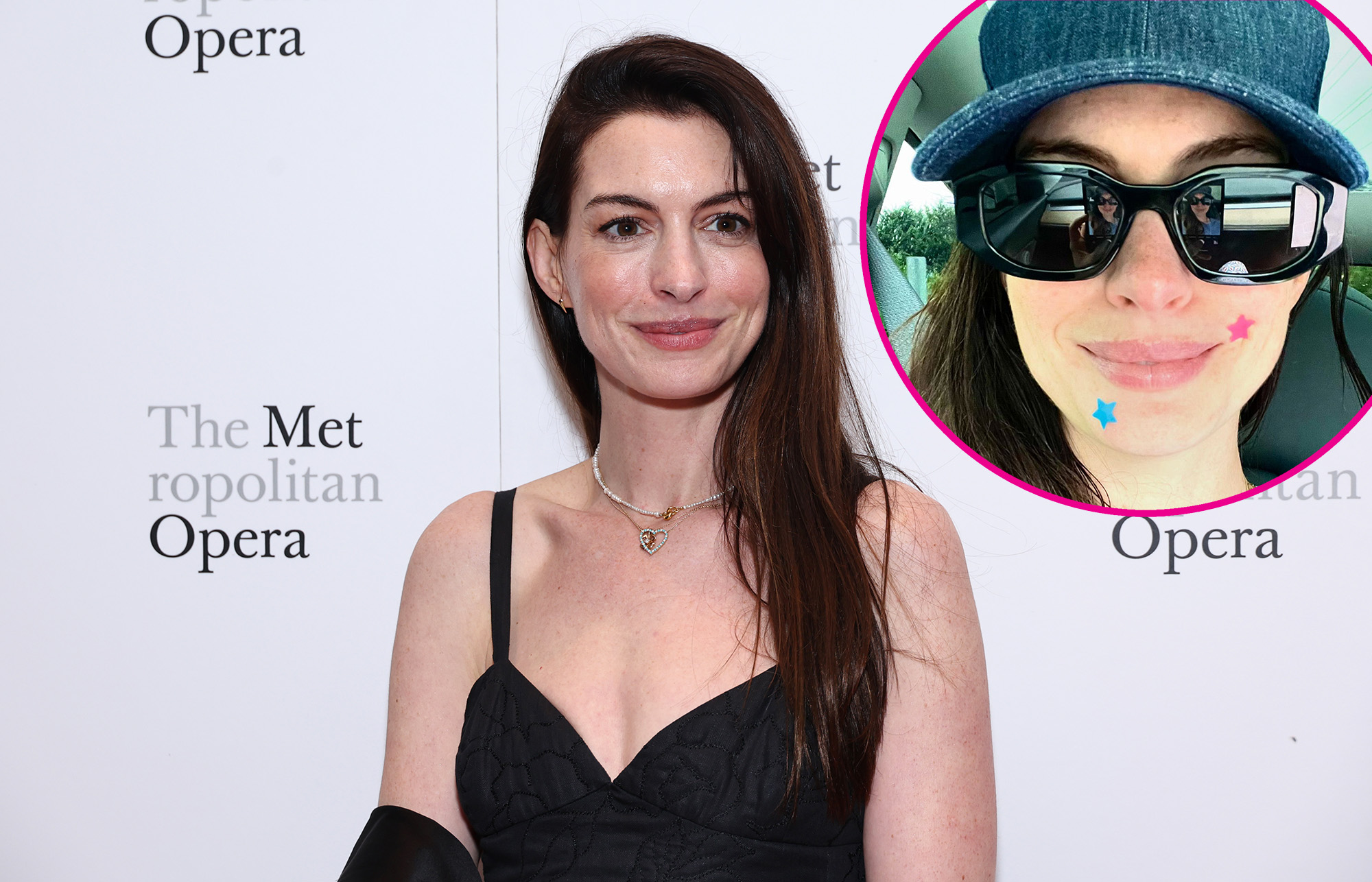 Anne Hathaway Knows She's Really 'Just Like Us,' Shows Off Pimple Patches