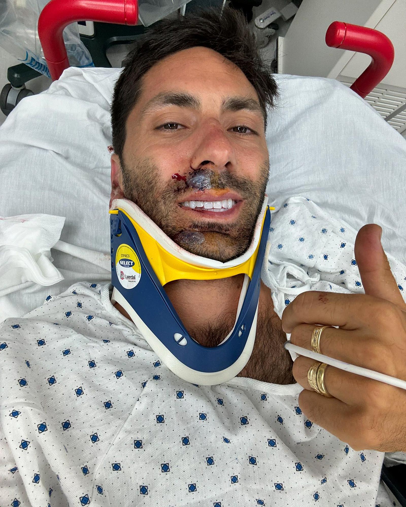 Nev Schulman, do Catfish, diz que tem ‘sorte de estar aqui’ após acidente de bicicleta