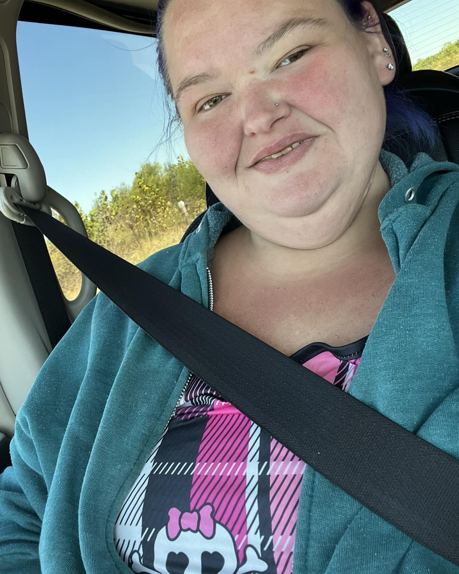 1000-Lb. Sisters’ Amy Slaton Went to the ER for Camel Bite Before Arrest