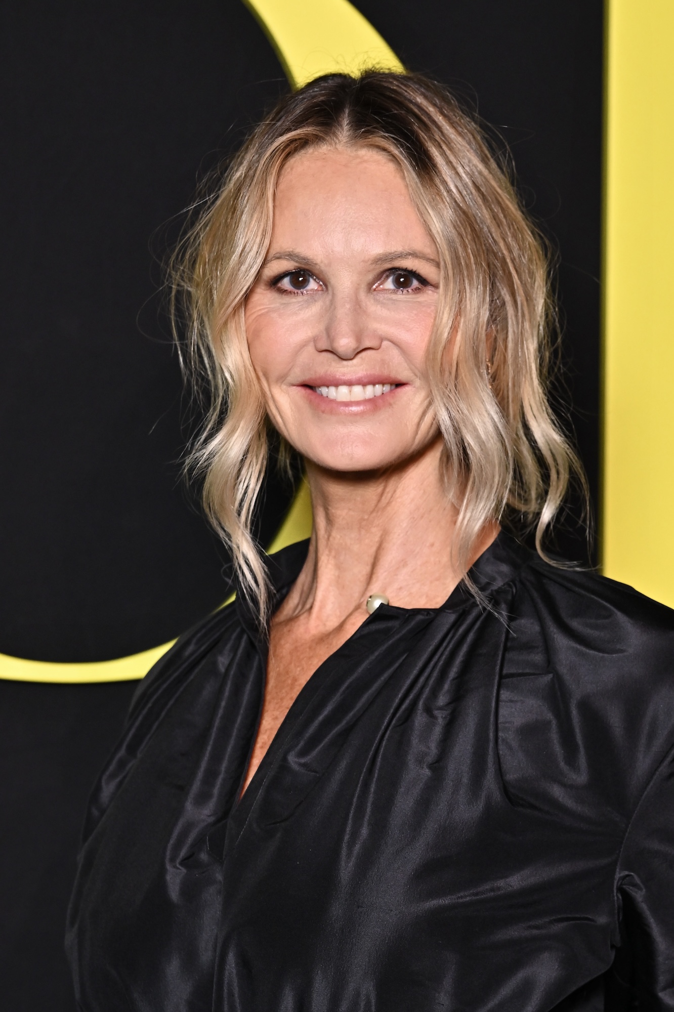 Elle Macpherson recibió 'consejo médico' antes del tratamiento holístico contra el cáncer