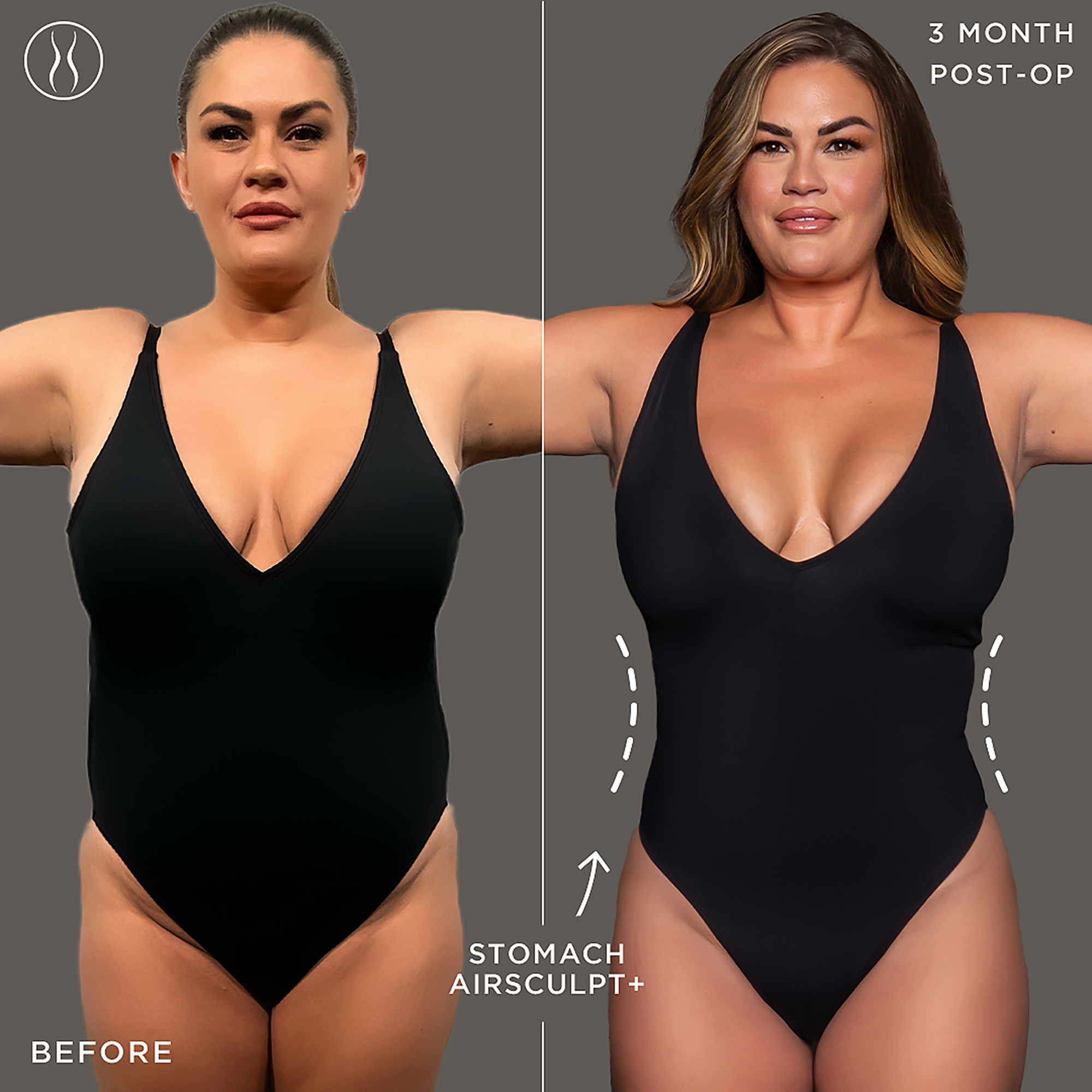 See Brittany Cartwright's Before and After AirSculpt Photos