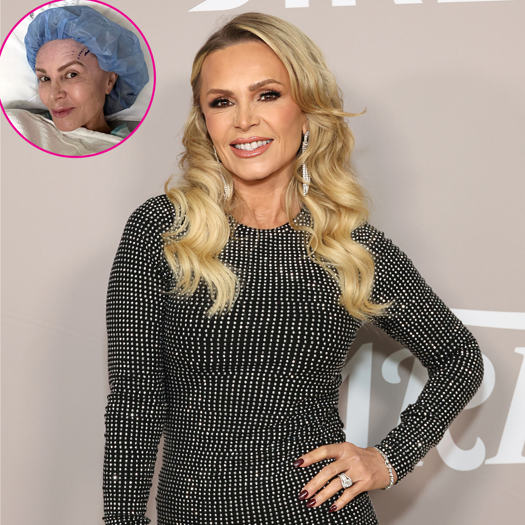 RHOC’s Tamra Judge Gets a Brow Lift: ‘Let the Healing Begin’