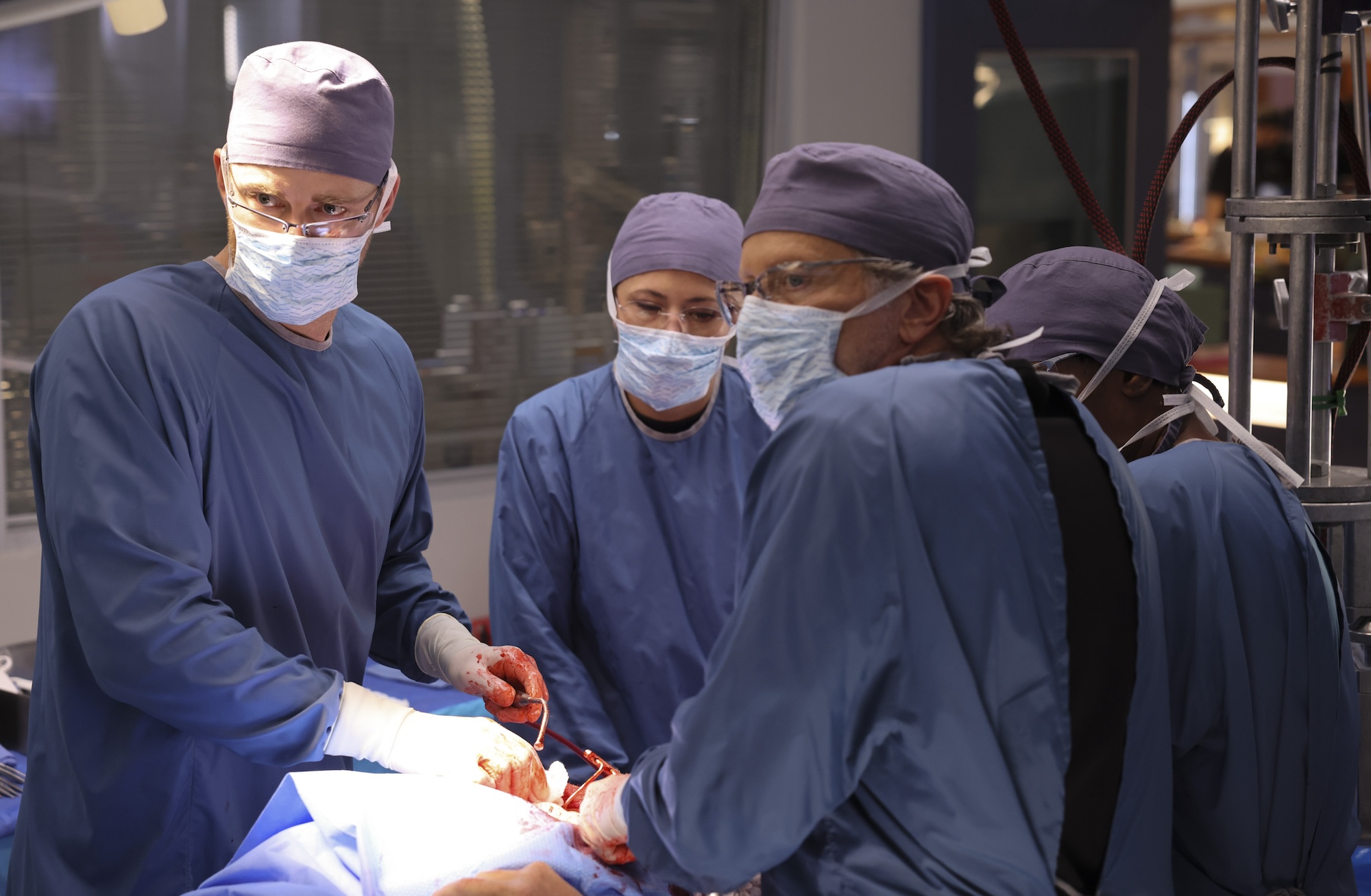 Ask Us: What Do Medical Dramas Use for Organs in Surgery Scenes? 