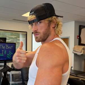 Feature Logan Paul Posts Grotesque Photos After Tricep Surgery