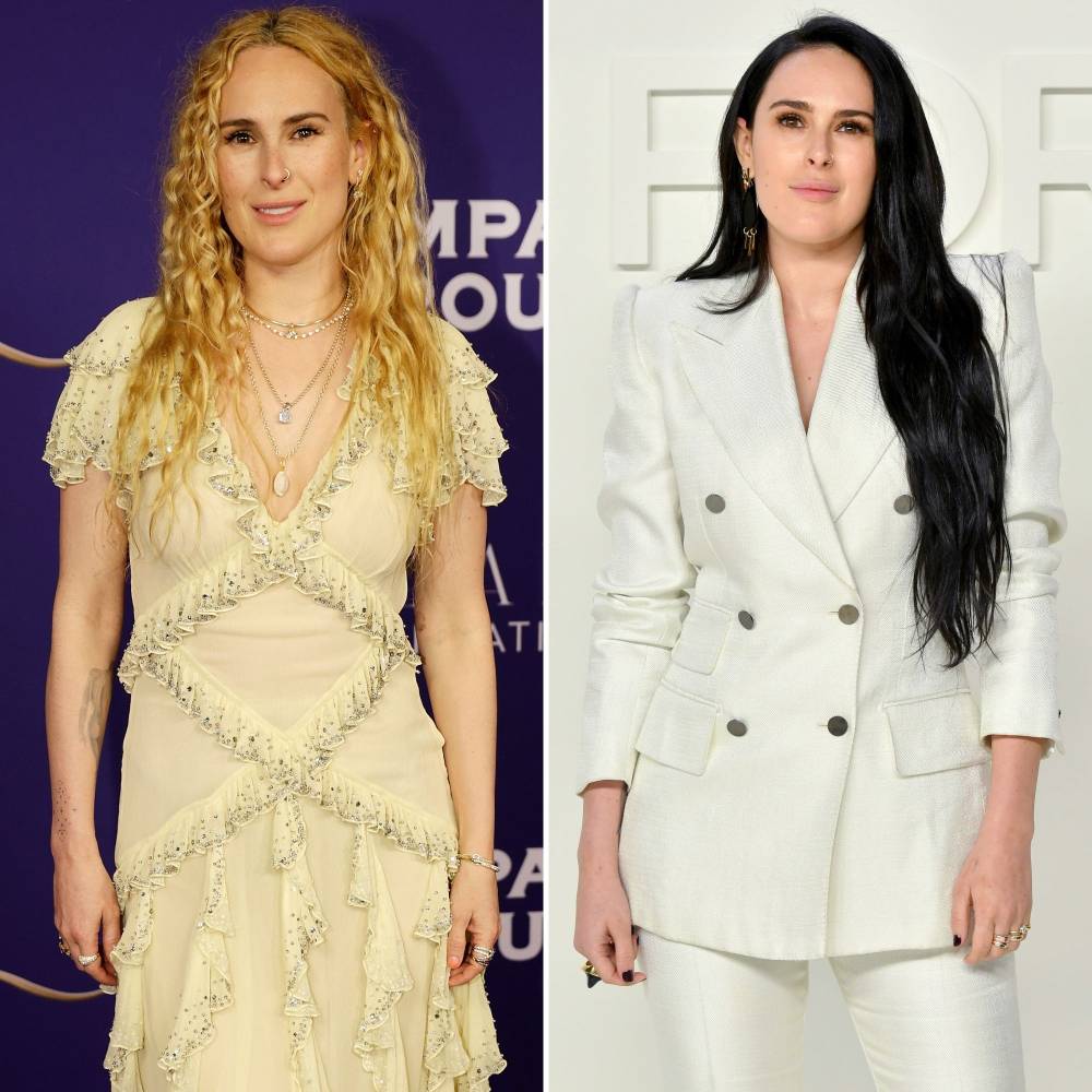 Rumer Willis Reveals Why Her Face Physically Changed Shuts Down Plastic Surgery Rumors