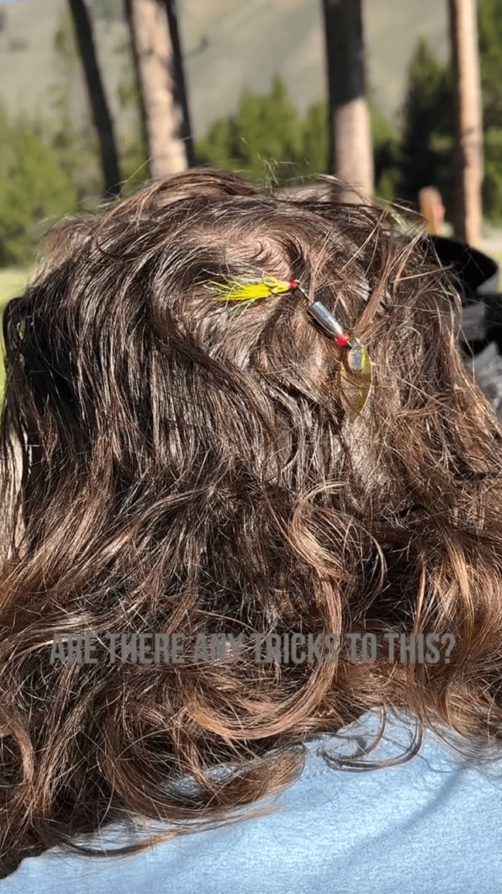 Country Singer Tyler Hubbard Wife Removes Fish Hook From His Head in Wild Camping Trip Video Injury