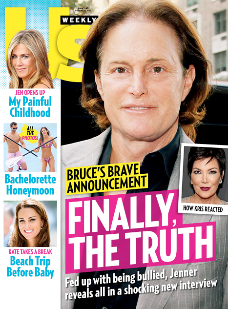 Bruce Jenner Pouts New Plump Lips, Lets Long Hair Flow: Photos