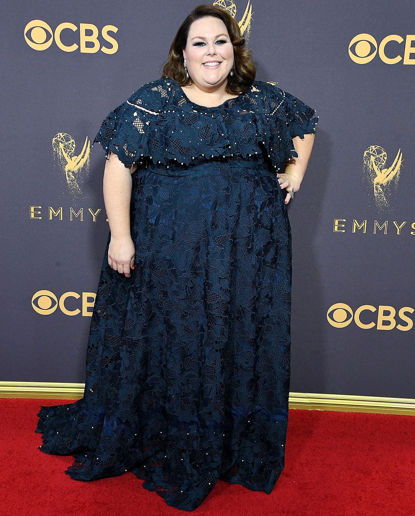 Chrissy Metz: Don’t Ask Me About Gastric Bypass Surgery